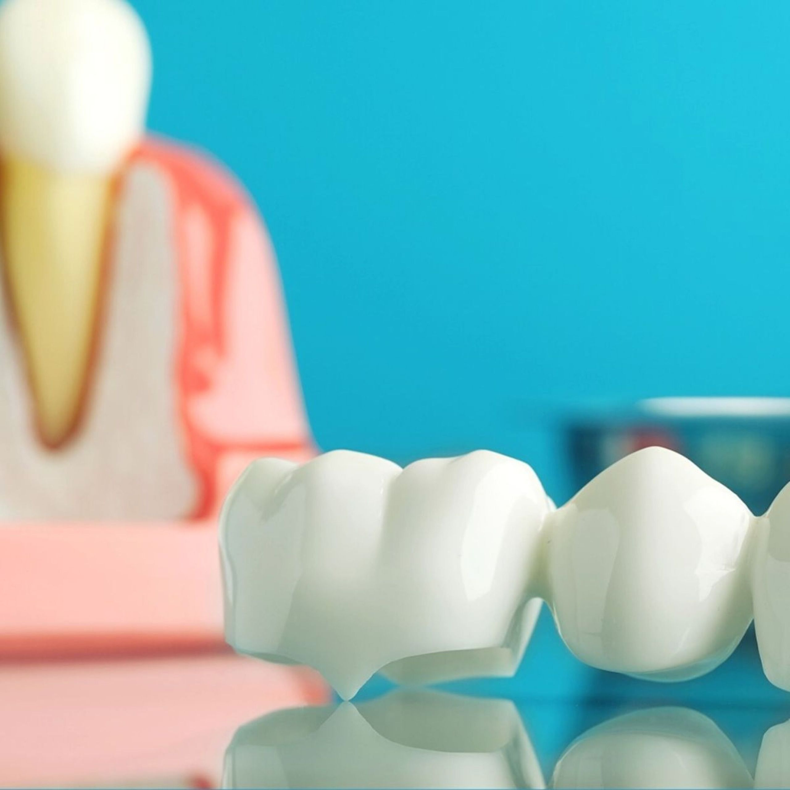 Close-up of a dental prosthetic on a reflective surface with a tooth model in the background.