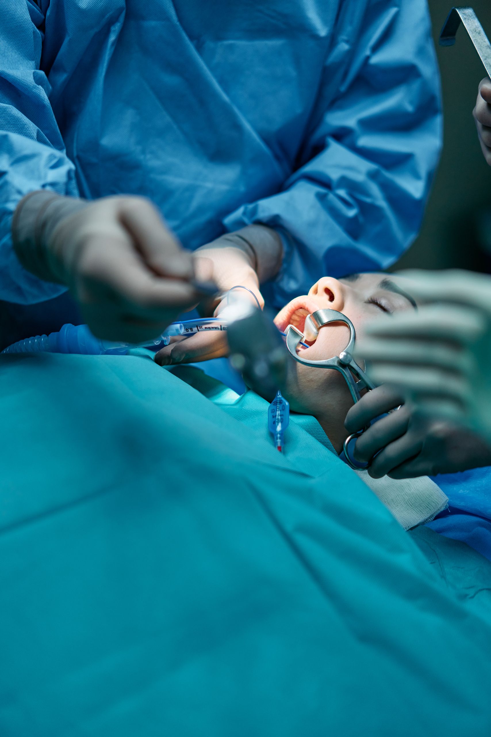 Close-up of a surgical team conducting an oral procedure in a sterile hospital environment.