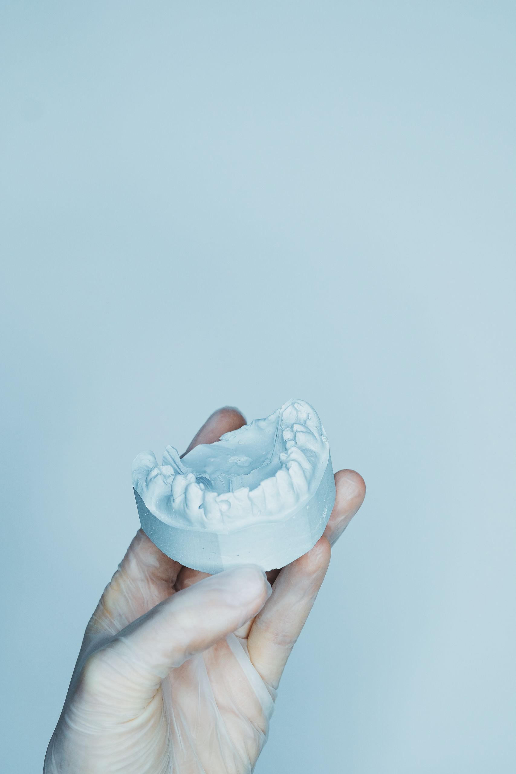 Detailed image of a dental mould held by a gloved hand, ideal for healthcare topics.